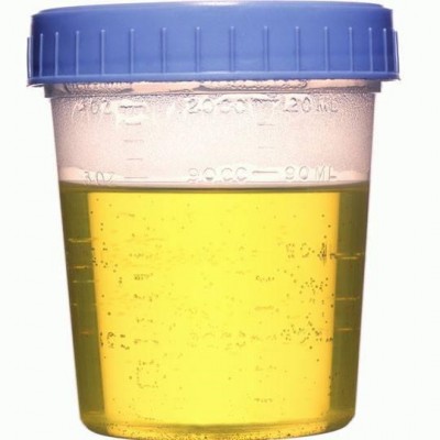 Hot sale Good quality Medical disposable urine cup measuring cup for urine